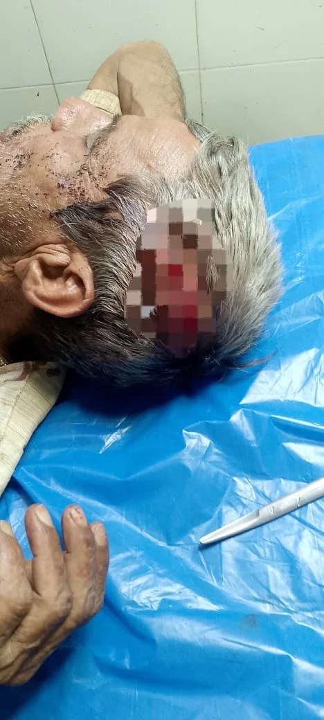 बहोरीबंद के भकरवारा में वृद्ध पर कुल्हाड़ी से जान लेवा हमला, जमीन बेचने के बाद पुनः कब्जा बना हमले का कारण